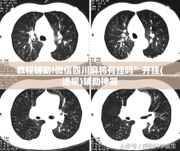 教程辅助!微信四川麻将有挂吗”开挂(透视)辅助神器
