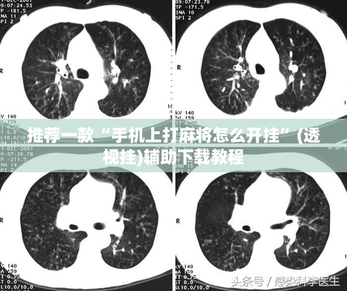 推荐一款“手机上打麻将怎么开挂”(透视挂)辅助下载教程