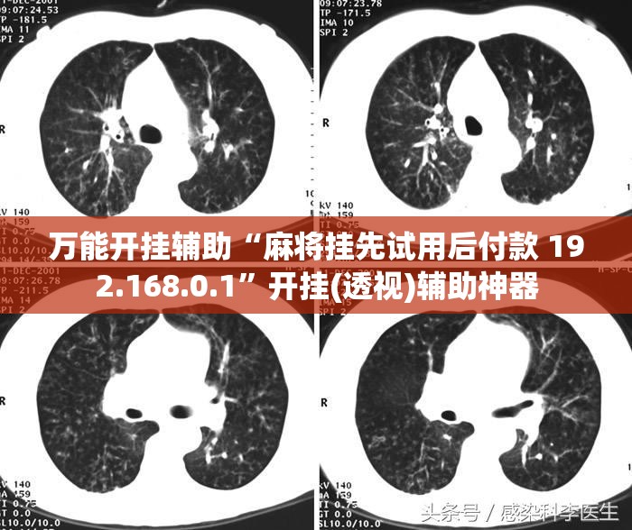 万能开挂辅助“麻将挂先试用后付款 192.168.0.1”开挂(透视)辅助神器