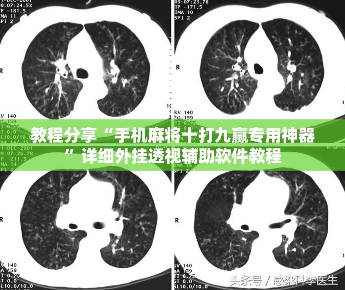 教程分享“手机麻将十打九赢专用神器	”详细外挂透视辅助软件教程