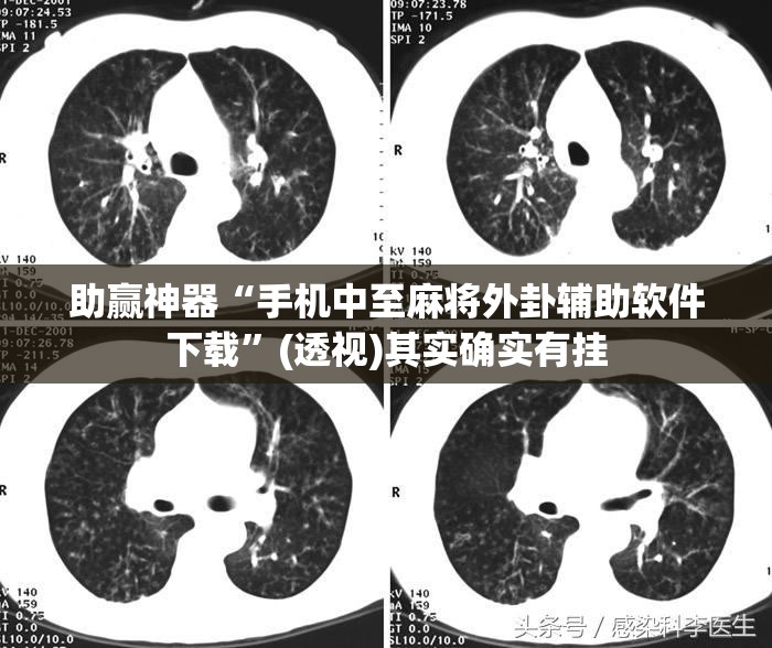 助赢神器“手机中至麻将外卦辅助软件下载”(透视)其实确实有挂