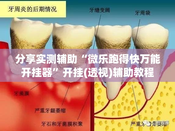 分享实测辅助“微乐跑得快万能开挂器	”开挂(透视)辅助教程
