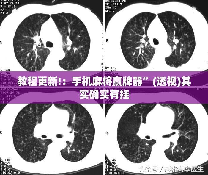 教程更新!：手机麻将赢牌器	”(透视)其实确实有挂