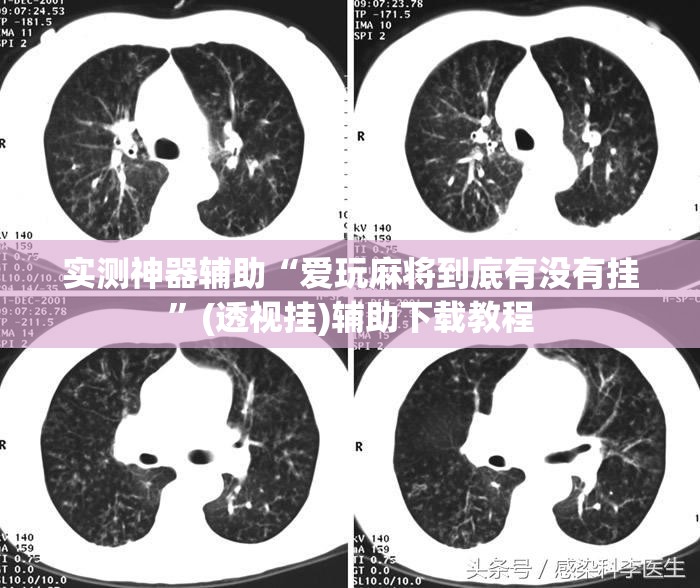 实测神器辅助“爱玩麻将到底有没有挂	”(透视挂)辅助下载教程
